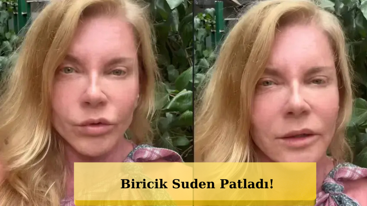 Estetik Diyorlardı! Biricik Suden Gerçeği Açıkladı