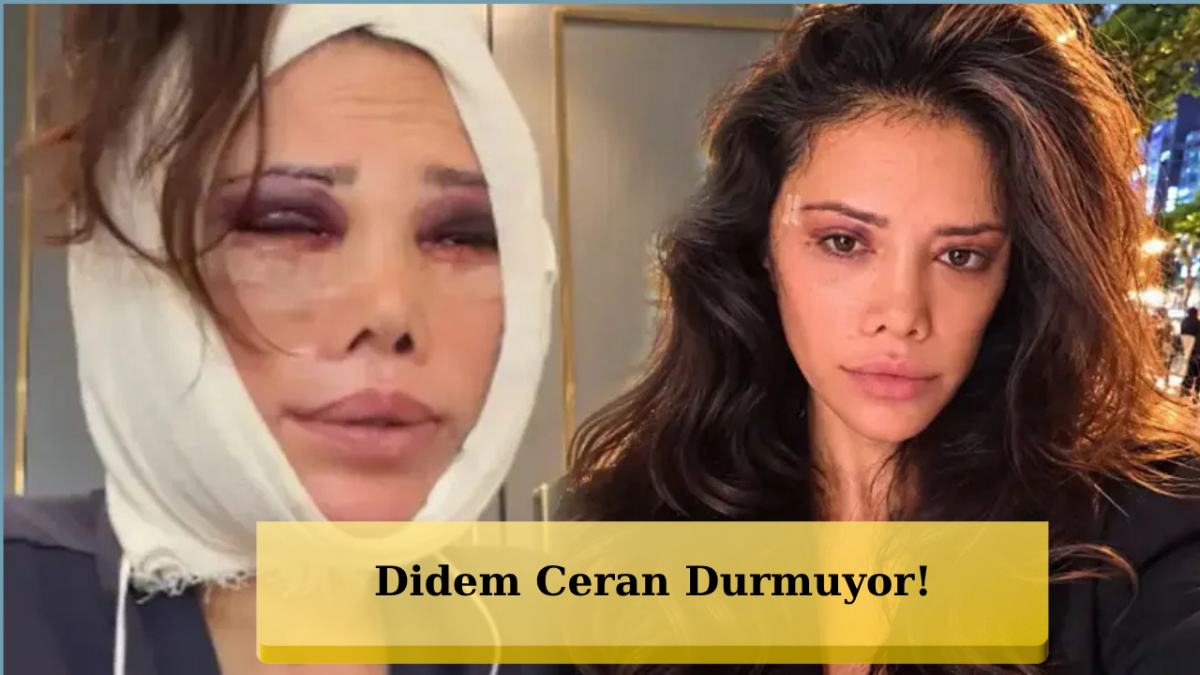 Didem Ceran Yine Bıçak Altında! Şimdi Sırada Kim Kardashian