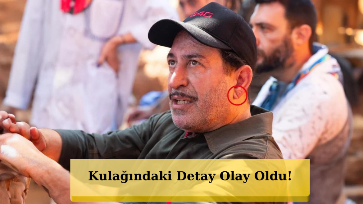 Cem Yılmaz’ın Kulağındaki Çizgi Neyi Gösteriyor?