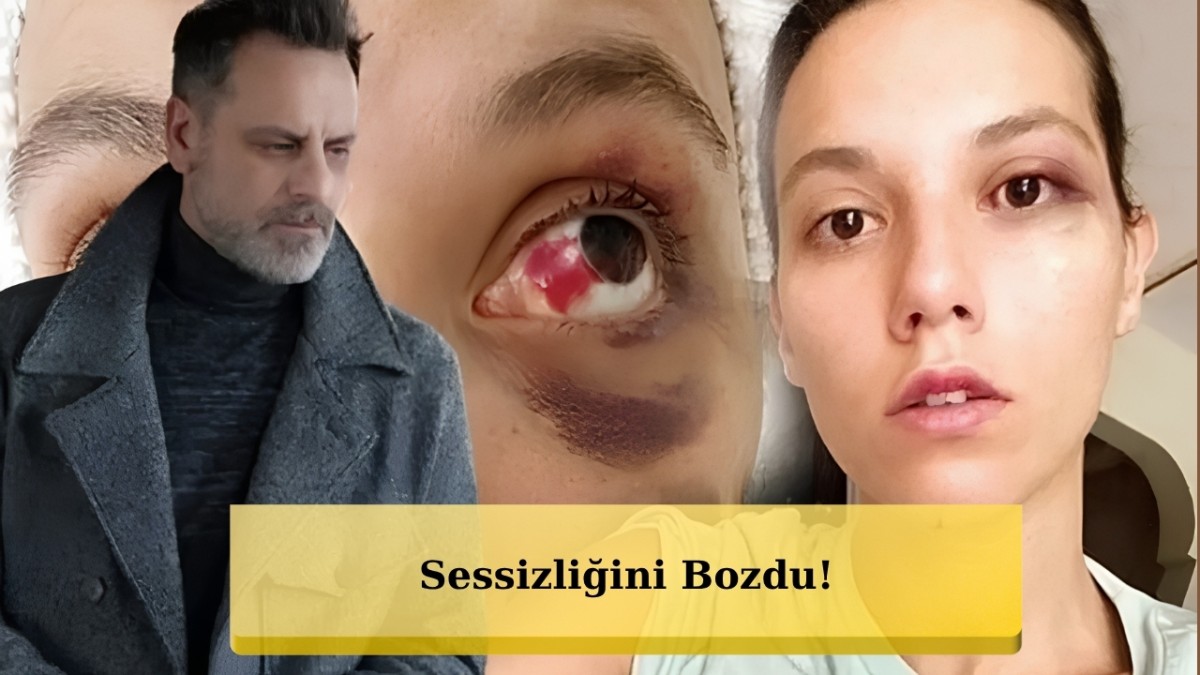 Ozan Güven Sessizliğini Bozdu: 