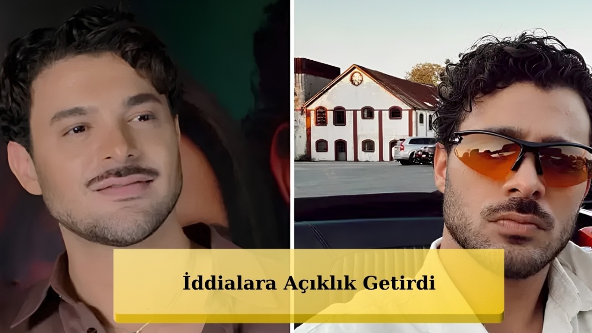 Halit Özgür Sarı'dan Estetik İddialarına Yanıt