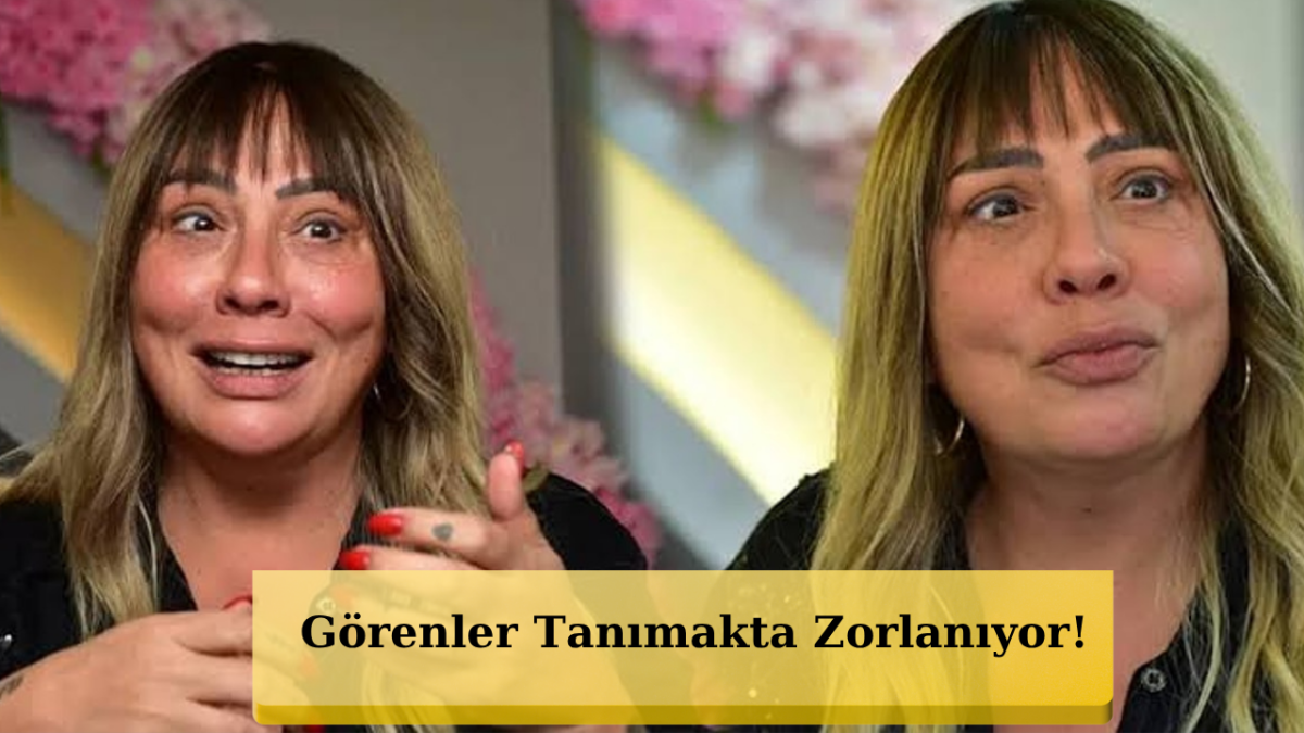 130 Kilodan 55 Kiloya Düştü! Işın Karaca'nın Yüzündeki Değişim Görenleri Şaşkına Çevirdi