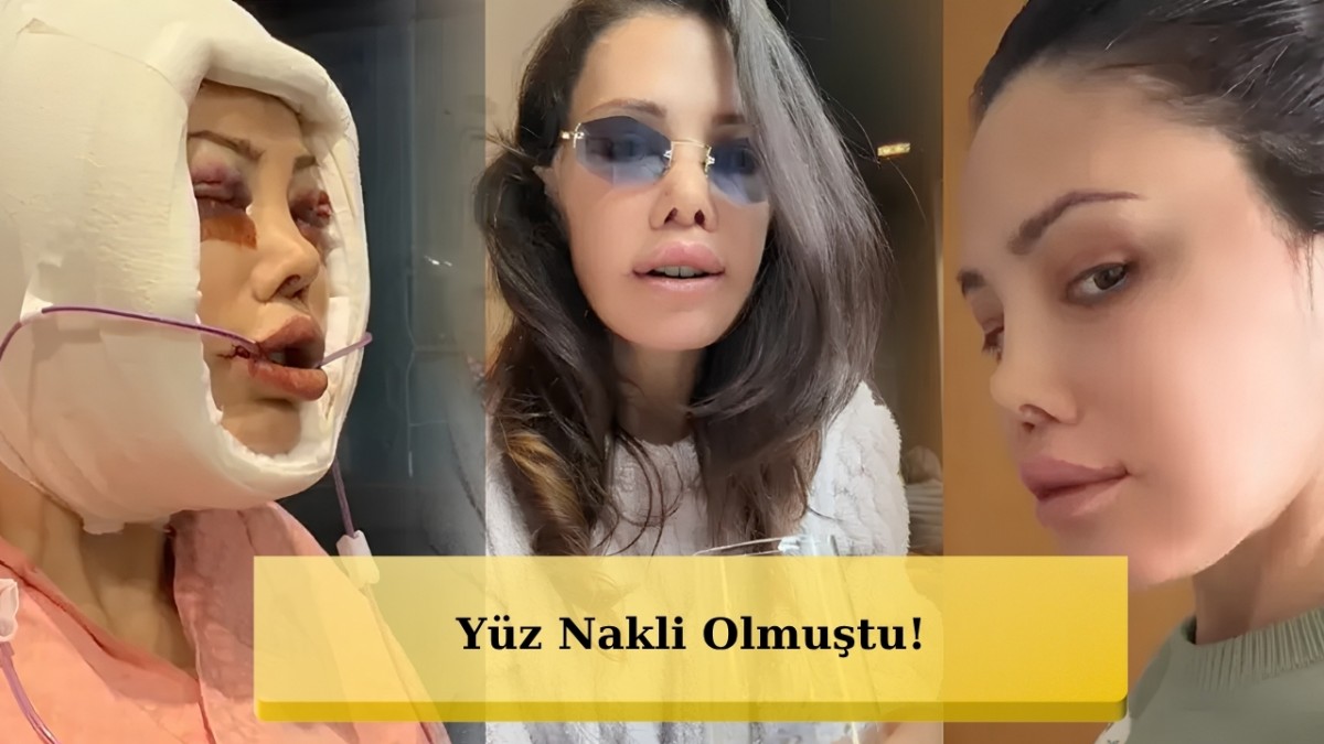 Yüz Nakli Ameliyatının Ardından Siber Zorbalığa Uğrayan Didem Ceran Sert Konuştu