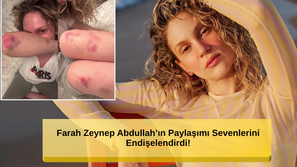 Farah Zeynep Abdullah’ın Son Hali Korkuttu! Vücudundaki Morluklar Dikkat Çekti