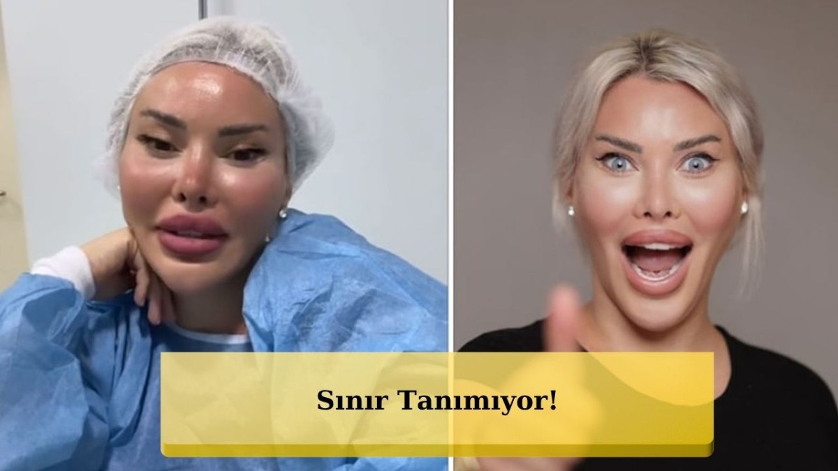 Yemekteyiz ile Tanınan Pınar Özkurteller Ameliyatla Göz Rengini Değiştirdi