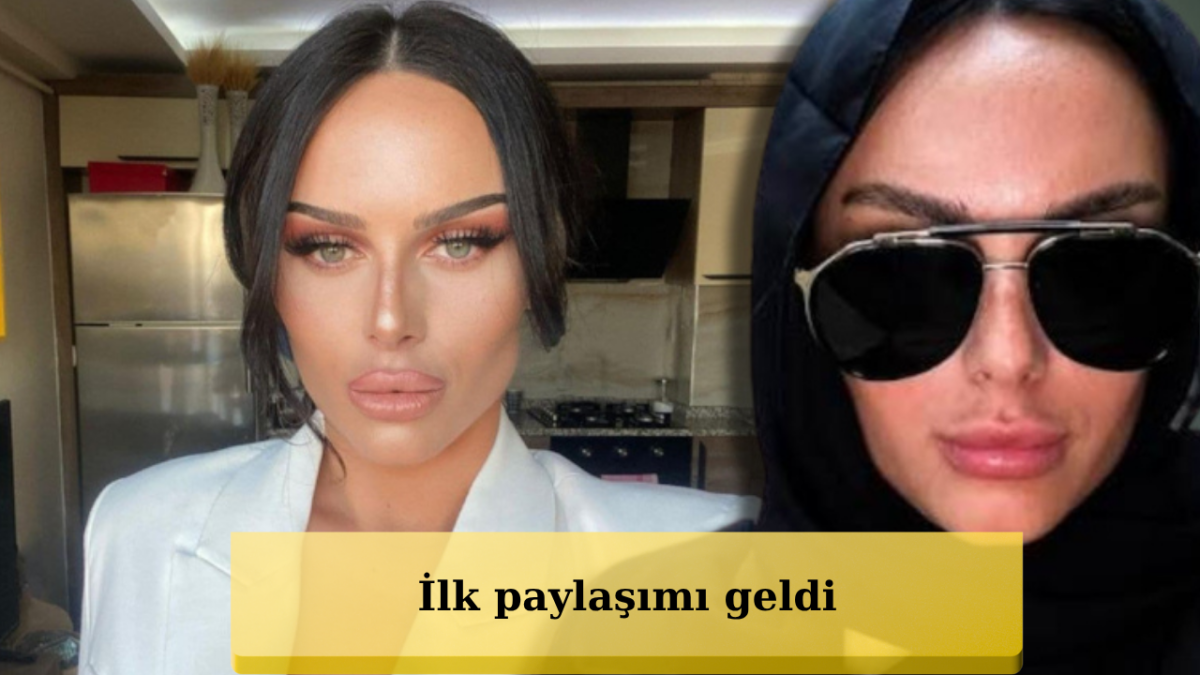 Kısmetse Olur Yaren Dağ 1,5 Yıl Sonra Yeniden Açıldı! Fotoğrafları Tek Kalemde Sildi