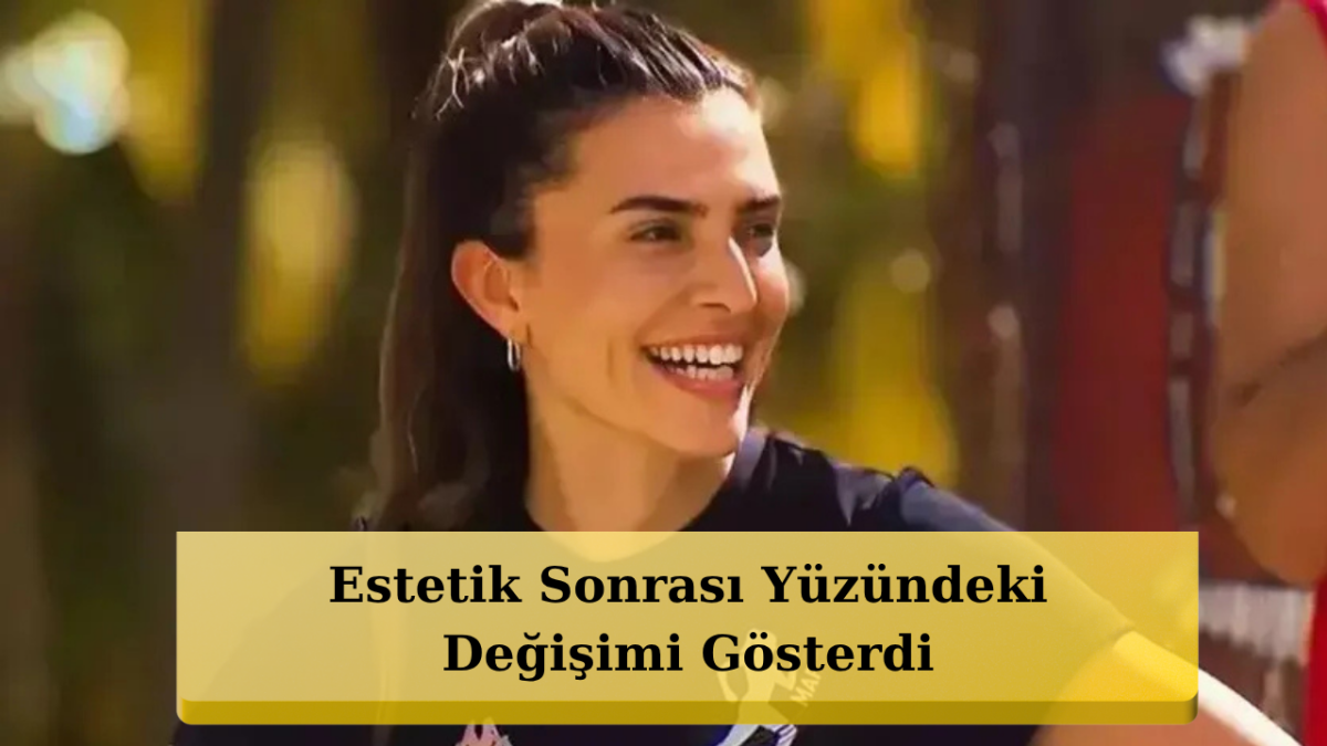 Survivor Merve Aydın'ın Son Haline Kimse İnanamadı!