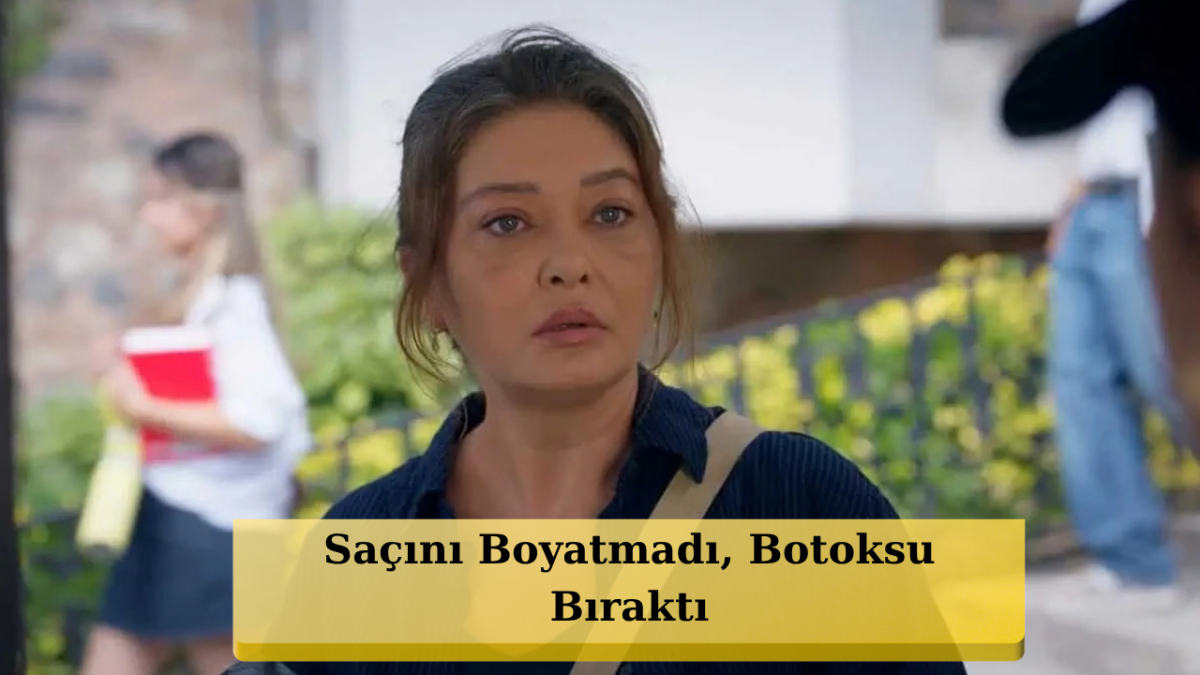 Nurgül Yeşilçay Ömür Usta İçin Botoksu Bıraktı: Doğal Hali Gündem Oldu!