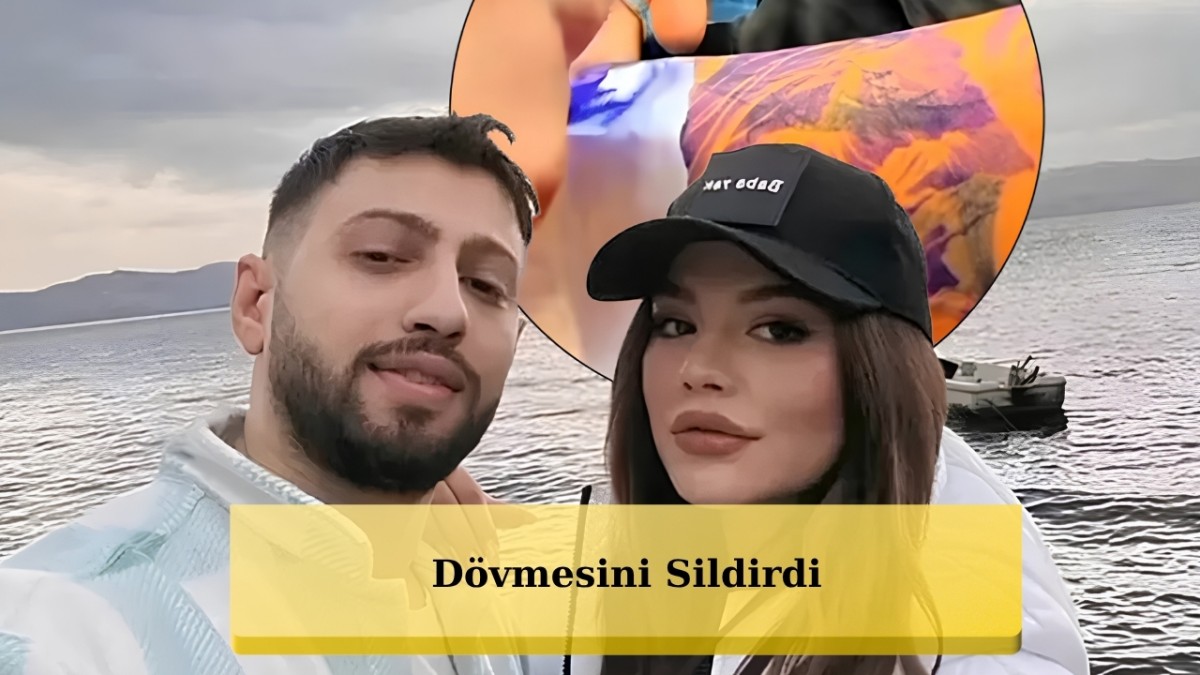 Burak Bulut, Eski Eşi Eda Sakız'ın Göz Dövmesini Kapattırdı!