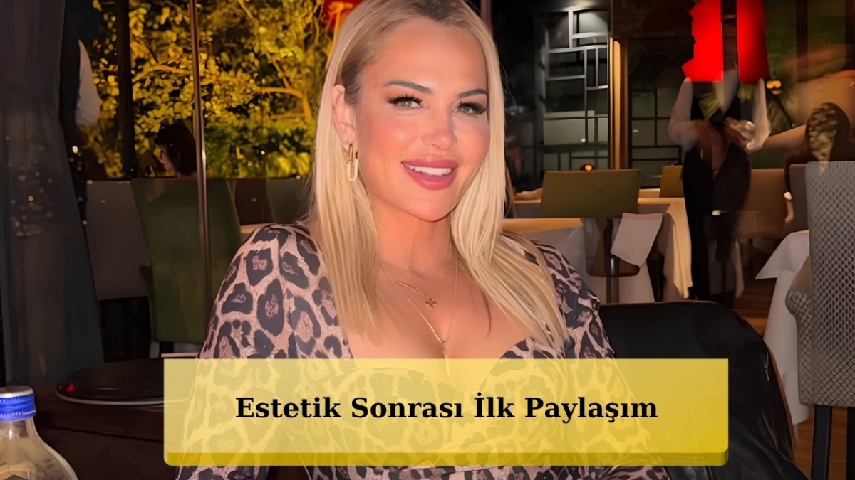 Survivor 2026 Finalisti Nagihan Karadere'nin Estetik Sonrası İlk Görüntüleri!