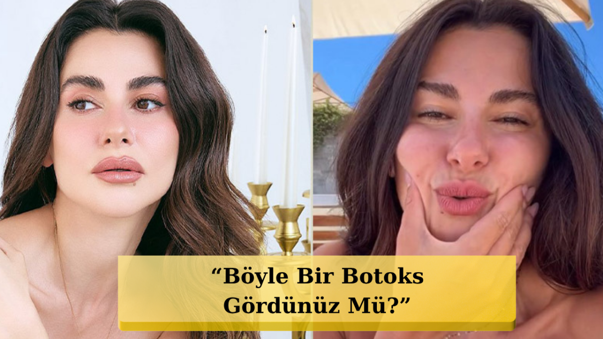Nesrin Cavadzade'den Botoks İddialarına Mimikli Yanıt