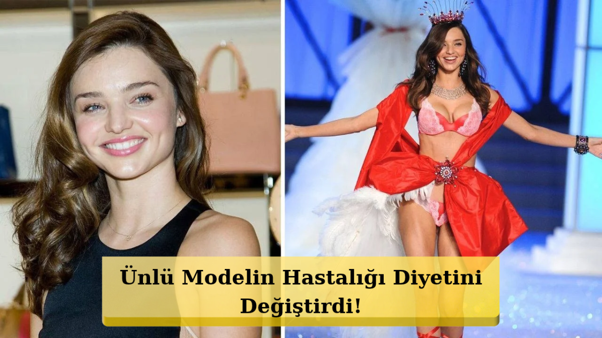 Miranda Kerr’nin Diyeti Şaşırttı! Yumurta Yok Geyik Eti Var